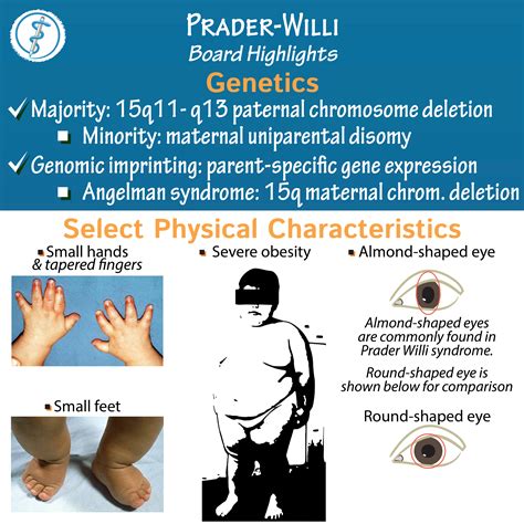 prada william syndrome|prader willi syndrome survival rate.